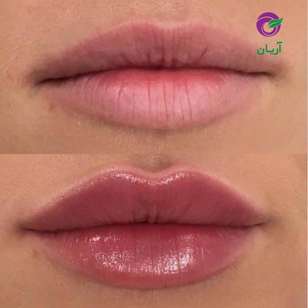 رژلب مایع حجم دهنده صورتی/شماره 124 /برند لاکچری کوین | خداحافظی با لبهای کمحجم؛ ظاهر پرتر و حجیمتر، رنگ صورتی جذاب و پوشش یکدست – ۱عددی
